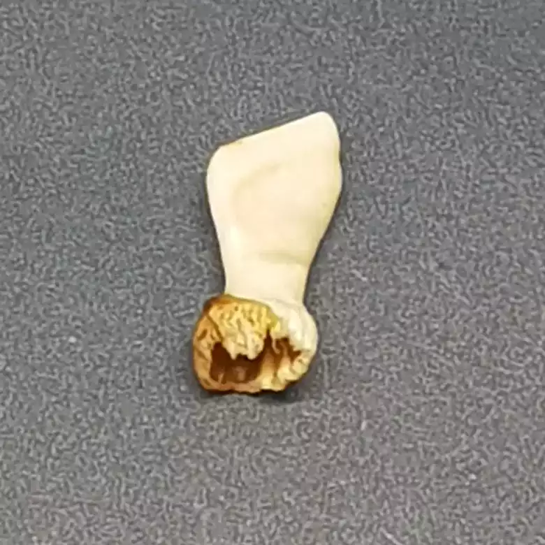 Natural Ketu Mukta Mani - Image 6